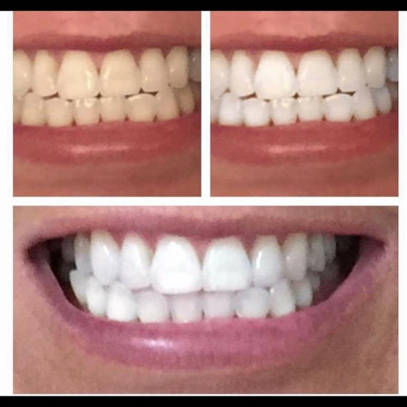 New-Three (3)Nuskin Ap24 Whitening Fluoride Toothpaste - Picture 8 of 17